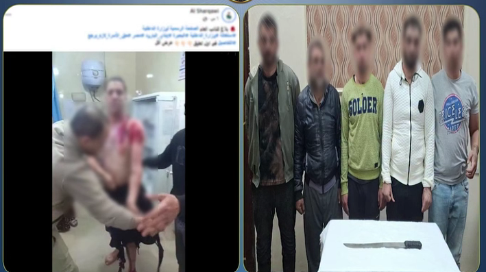 كشف ملابسات واقعة اعتداء باستخدام مادة حارقة وسلاح أبيض بالبحيرة
